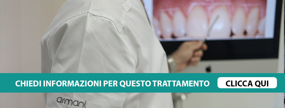 digital-smile-design-Verona