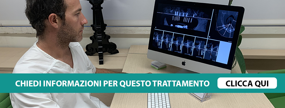Implantologia All on six Verona