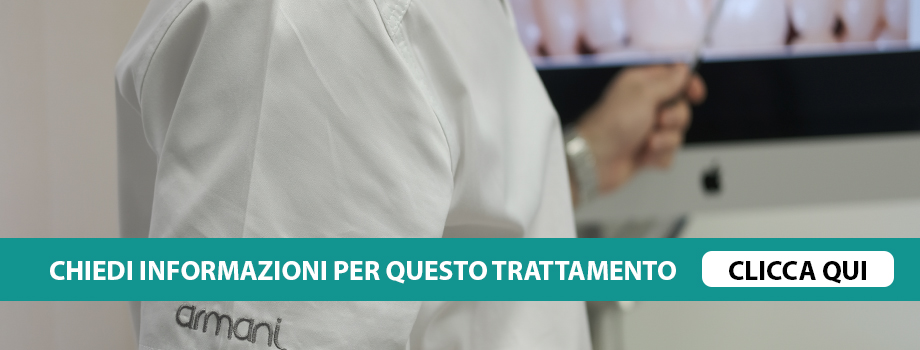 protesi-conometrica-verona