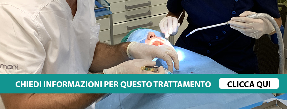 sbiancamento-dentale-verona