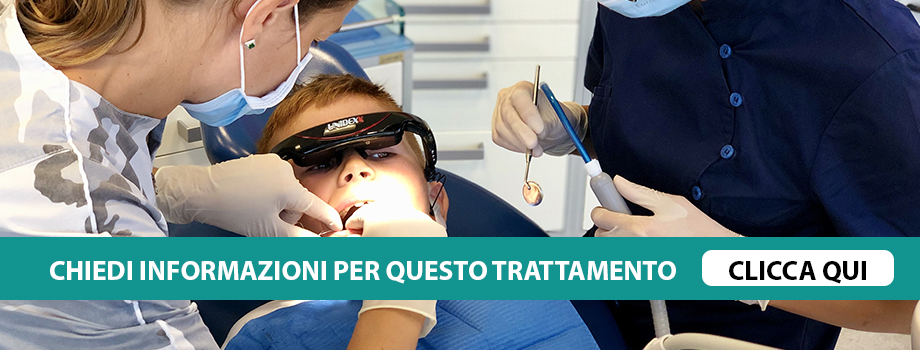 trattamento-denti-da-latte-verona